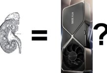 A picture of a kidney, an equals sign, an RTX 3090 and a question mark